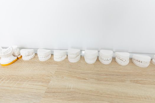 Row of Dental casting gypsum models plaster cast on a table in clinic