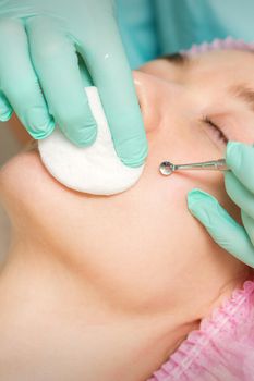The beautician removes blackhead and acne on the female face in a beauty salon, blackhead removal tool