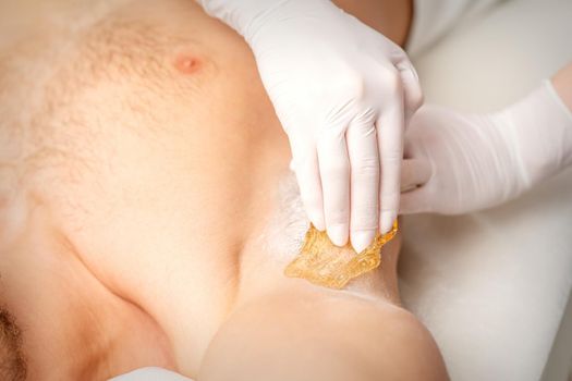 Young caucasian man receiving hair removal from his armpit in a beauty salon, depilation men's underarm