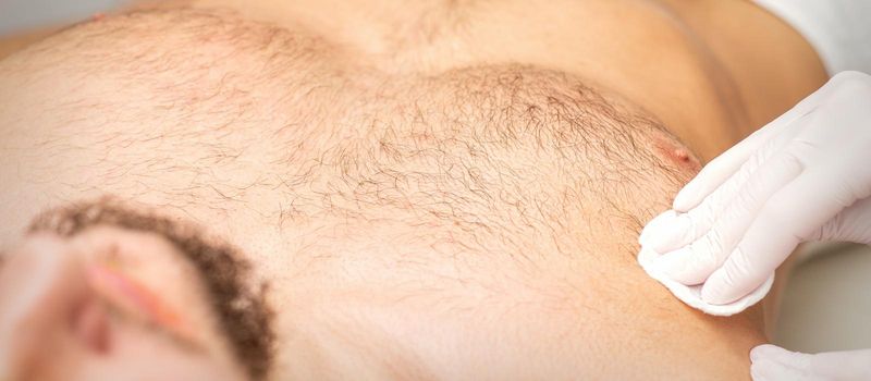 Young caucasian man receiving hair removal from his chest in a beauty salon, depilation men's torso