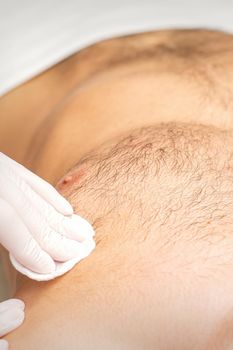 Young caucasian man receiving hair removal from his chest in a beauty salon, depilation men's torso