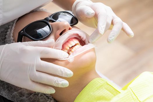 Patient with cheek retractor lying in dentist office in modern clinic