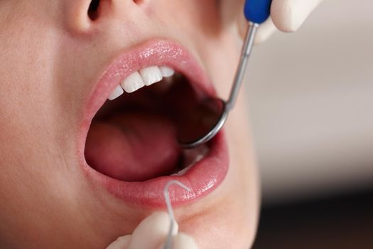 Dental examination. Closeup of female patient during dental treatment