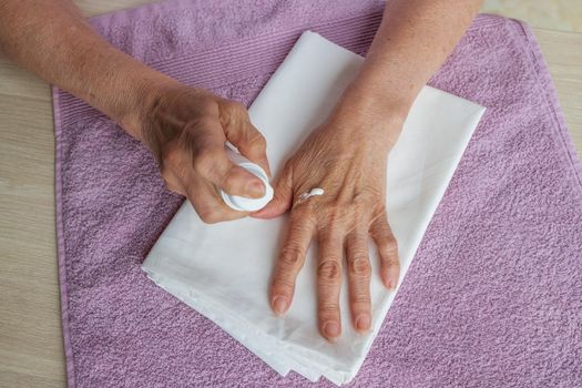 Close-up, Hands of an elderly woman with wrinkles and arthritis on a white and pink towel. An old woman applies a moisturizing, healing cream to her hands. The concept of self-care, disease prevention