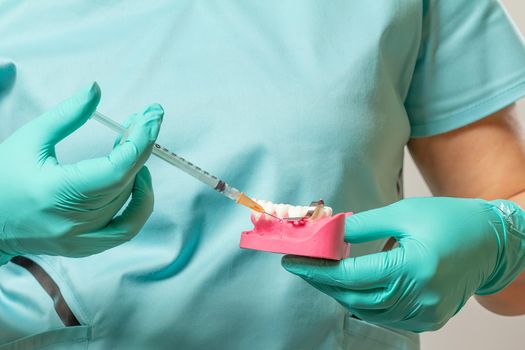 Dentist's hands holding a layout of the human jaw and a syringe with anesthetic.