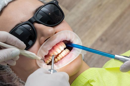 Patient with cheek retractor lying in dentist office in modern clinic