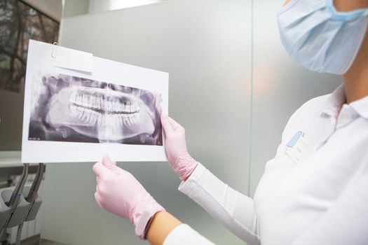 Cropped shot of female dentist wearing medical mask showing jaw x-ray scan to the camera