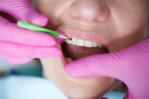 Cropped close up of dentist using interdental toothbrush cleaning between teeth of patient