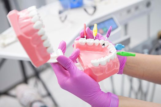 Cropped close up of dentists hands holding jaw model with interdental brushes between teeth