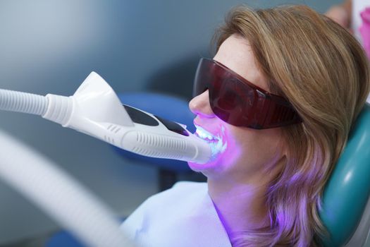 Close up of a mature woman getting teeth whitened at dentists office, wearing protective glasses