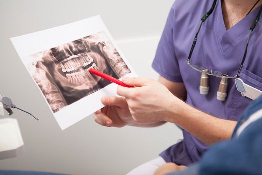 Unrecognizable dentist showing dental x-ray scan to a patient