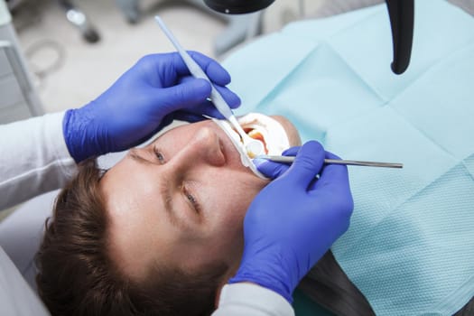 Cropped close up of a male patient on dental examination at the clinic