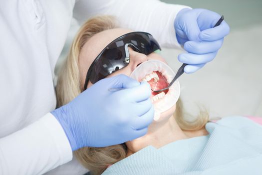 Close up of a woman getting dental treatment at dentists office