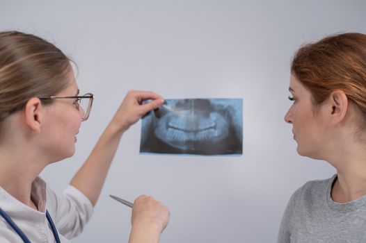 A woman doctor and a patient at the reception are discussing an x-ray of the jaw