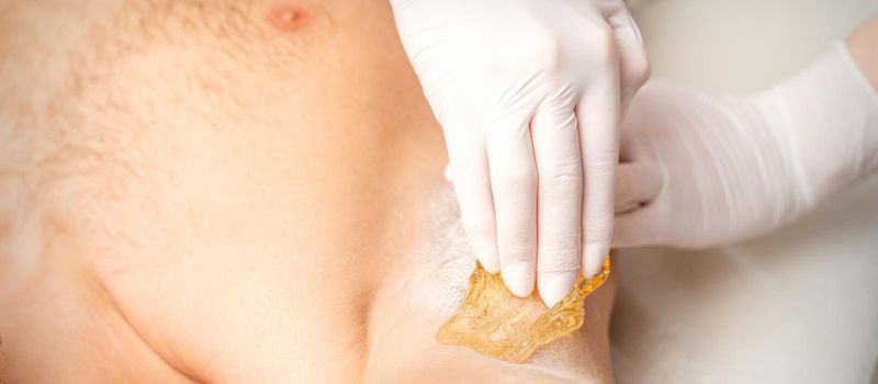 Young caucasian man receiving hair removal from his armpit in a beauty salon, depilation men's underarm