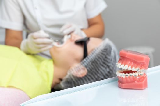 Orthodontic model and dentist tool. Teeth model of varities of orthodontic bracket or braces