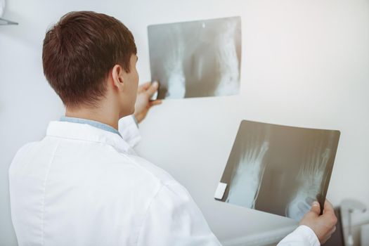 Rear view shot of an unrecognizable male doctor comparing two x-ray scans of a patient. Experienced doctor examining x-rays of his patient. Treatment, therapy, medicine concept
