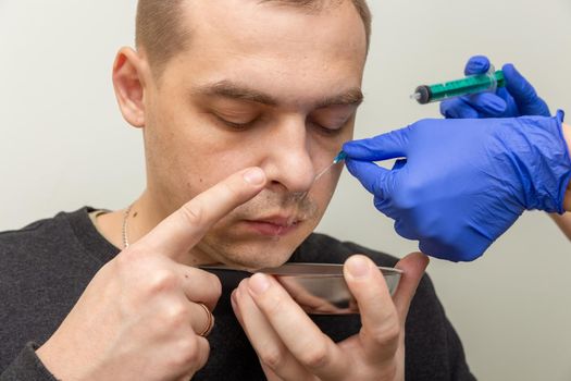 A nurse rinses the nasal cavity of a patient suffering from sinusitis with saline solution using a syringe.