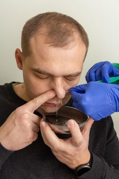 A nurse rinses the nasal cavity of a patient suffering from sinusitis with saline solution using a syringe.