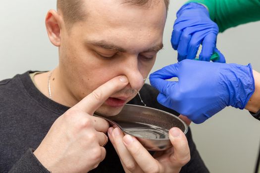 A nurse rinses the nasal cavity of a patient suffering from sinusitis with saline solution using a syringe.