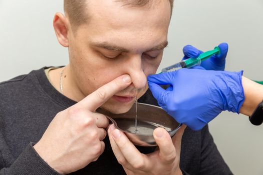 A nurse rinses the nasal cavity of a patient suffering from sinusitis with saline solution using a syringe.