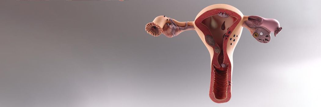 Closeup of artificial plastic model of uterus and ovaries on gray background. Gynecological education concept