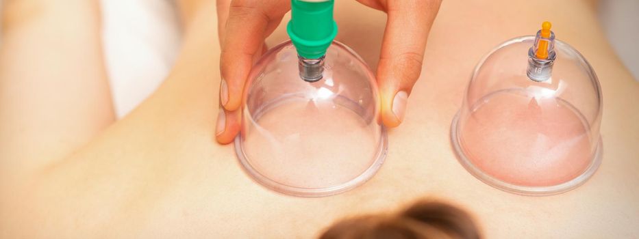 Woman receiving vacuum cupping treatment on back laying on the chest in massage salon