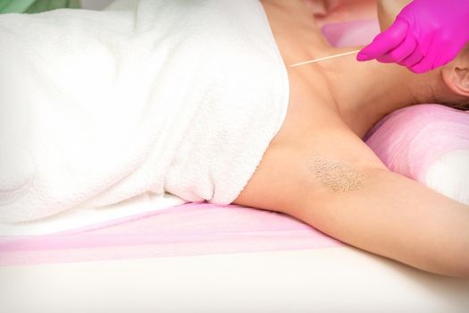 Hand in glove with spatula depilates female hairy armpit in a spa