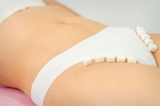Sugar cubes lying in a row on female bikini zone, the concept of intimate depilation, problems of intimate hygiene