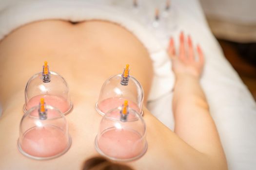 Young caucasian woman receiving cupping therapy in spa clinic. Islamic female medicine