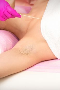 Hand in glove with spatula depilates female hairy armpit in a spa