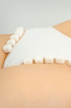 Sugar cubes lying in a row on female bikini zone, the concept of intimate depilation, problems of intimate hygiene
