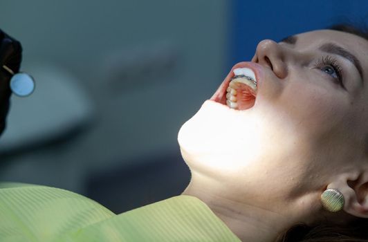 The process of removing braces.Beautiful woman in dental chair during procedure of installing braces to upper and lower teeth. Dentist and assistant working together, dental tools in their hands.