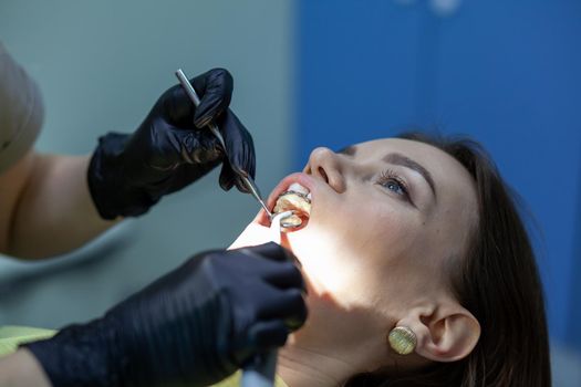 The process of removing braces.Beautiful woman in dental chair during procedure of installing braces to upper and lower teeth. Dentist and assistant working together, dental tools in their hands.