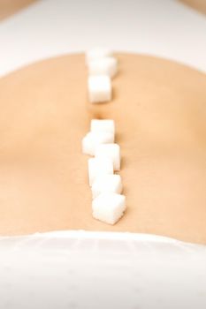 Sugar cubes lying in a row on abdomen of young woman, the concept of intimate depilation, problems of intimate hygiene