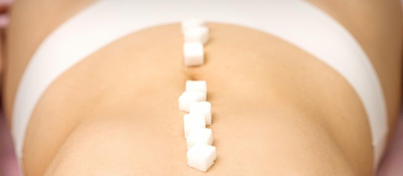 Sugar cubes lying in a row on abdomen of young woman, the concept of intimate depilation, problems of intimate hygiene