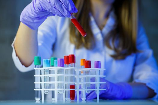 A medical professional, laboratory assistant, doctor performs an analysis in a laboratory, uses test tubes, a pipette and a petri dish for the presence of bacteria in the human body. Selective focus