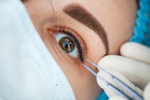 Medical laser eye correction. Medicine technology eye operation.