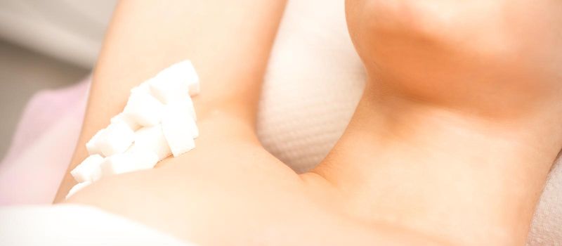 Sugaring, waxing concept. White sugar cubes lie down on the female armpit of the young white woman, close up