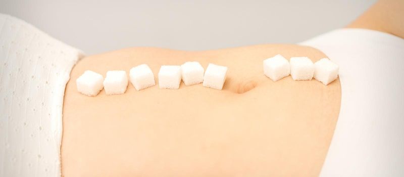 The concept of epilation, waxing. Sugar cubes lying in a row on the abdomen of a young white woman, close up