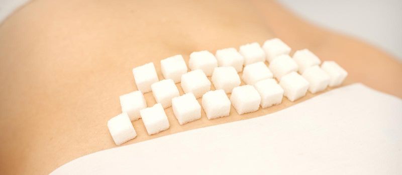 The concept of epilation, waxing, and intimate hygiene. Sugar cubes lying in a row on the bikini zone of a young white woman, close up