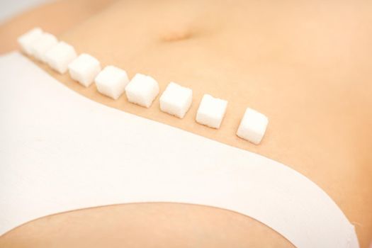 The concept of epilation, waxing, and intimate hygiene. Sugar cubes lying in a row on the bikini zone of a young white woman, close up