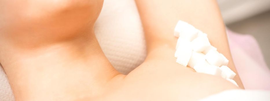 Sugaring, waxing concept. White sugar cubes lie down on the female armpit of the young white woman, close up