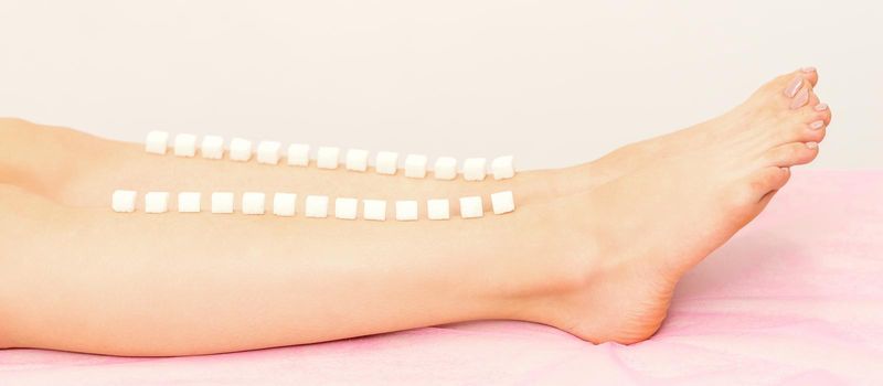 The concept of epilation, waxing. Sugar cubes lie down in a row on the naked white female leg