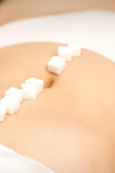 The concept of epilation, waxing. Sugar cubes lying in a row on the abdomen of a young white woman, close up