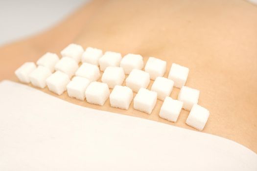 The concept of epilation, waxing, and intimate hygiene. Sugar cubes lying in a row on the bikini zone of a young white woman, close up