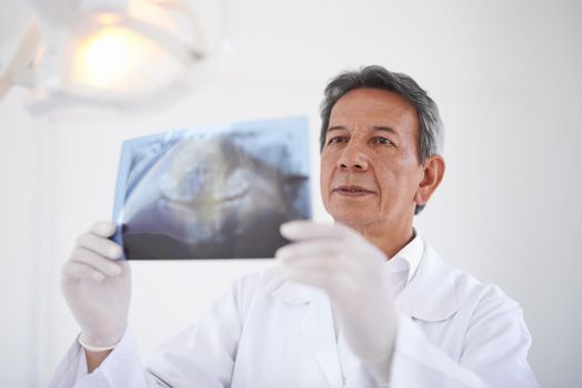 Hes checking on your teeth. a dentist looking at an x-ray