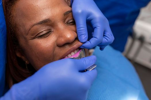 Close up view of a black woman patient being put on an impression tray inside her mouth at the dental clinic