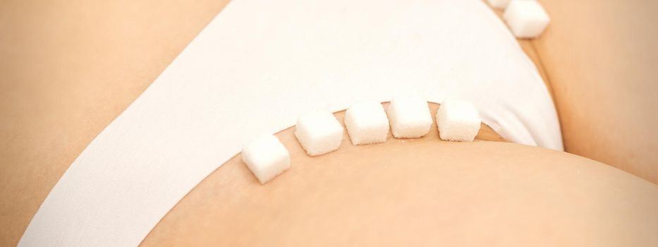 The concept of epilation, waxing, and intimate hygiene. Sugar cubes lying in a row on the bikini zone of a young white woman, close up