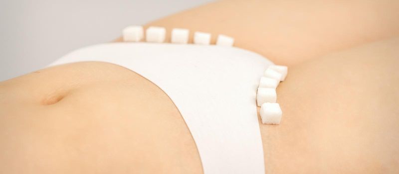 The concept of epilation, waxing, and intimate hygiene. Sugar cubes lying in a row on the bikini zone of a young white woman, close up